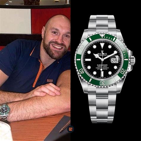 Tyson Fury's Watch Collection 